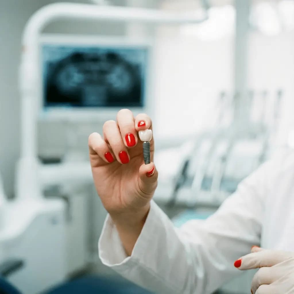 Implants Dentaires